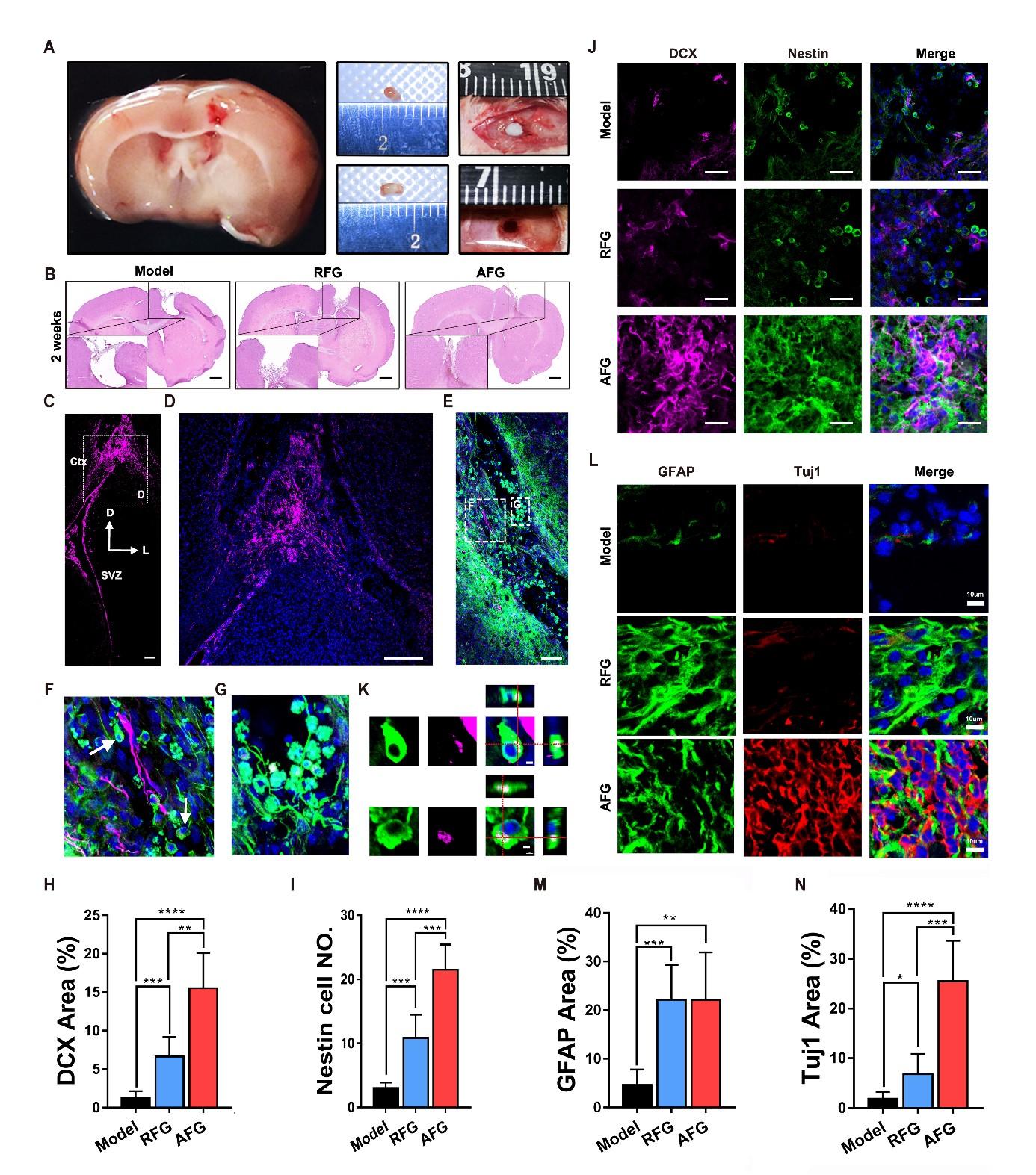 2021.12.3-材料学院王秀梅团队发现取向结构材料诱导大脑内源性神经干细胞的定向迁移和分化-王秀梅-图2AFG募集内源性神经干细胞的定向迁移和分化.jpg 2021.12.3-材料学院王秀梅团队发现取向结构材料诱导大脑内源性神经干细胞的定向迁移和分化-王秀梅-图2AFG募集内源性神经干细胞的定向迁移和分化.jpg